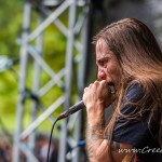 0249 Vulvodynia