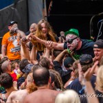0253 Vulvodynia