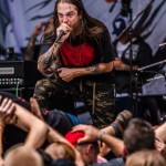 0254 Vulvodynia