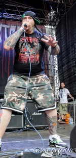 108 Epicardiectomy